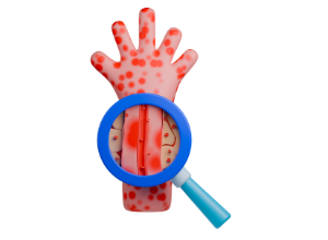 Porpora trombocitopenica immune: come si fa la diagnosi?