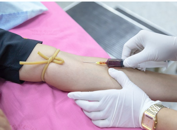 Esami del sangue: sapere leggere e comprendere i risultati di un test di funzionalità epatica